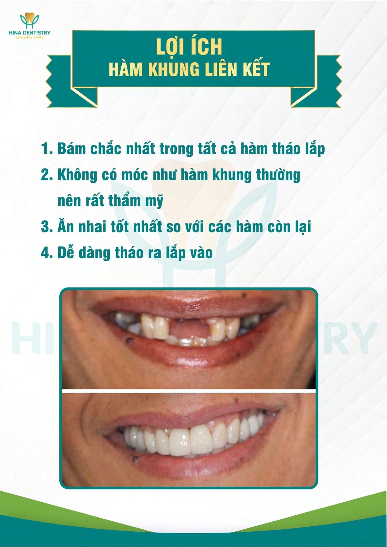 Bảng giá