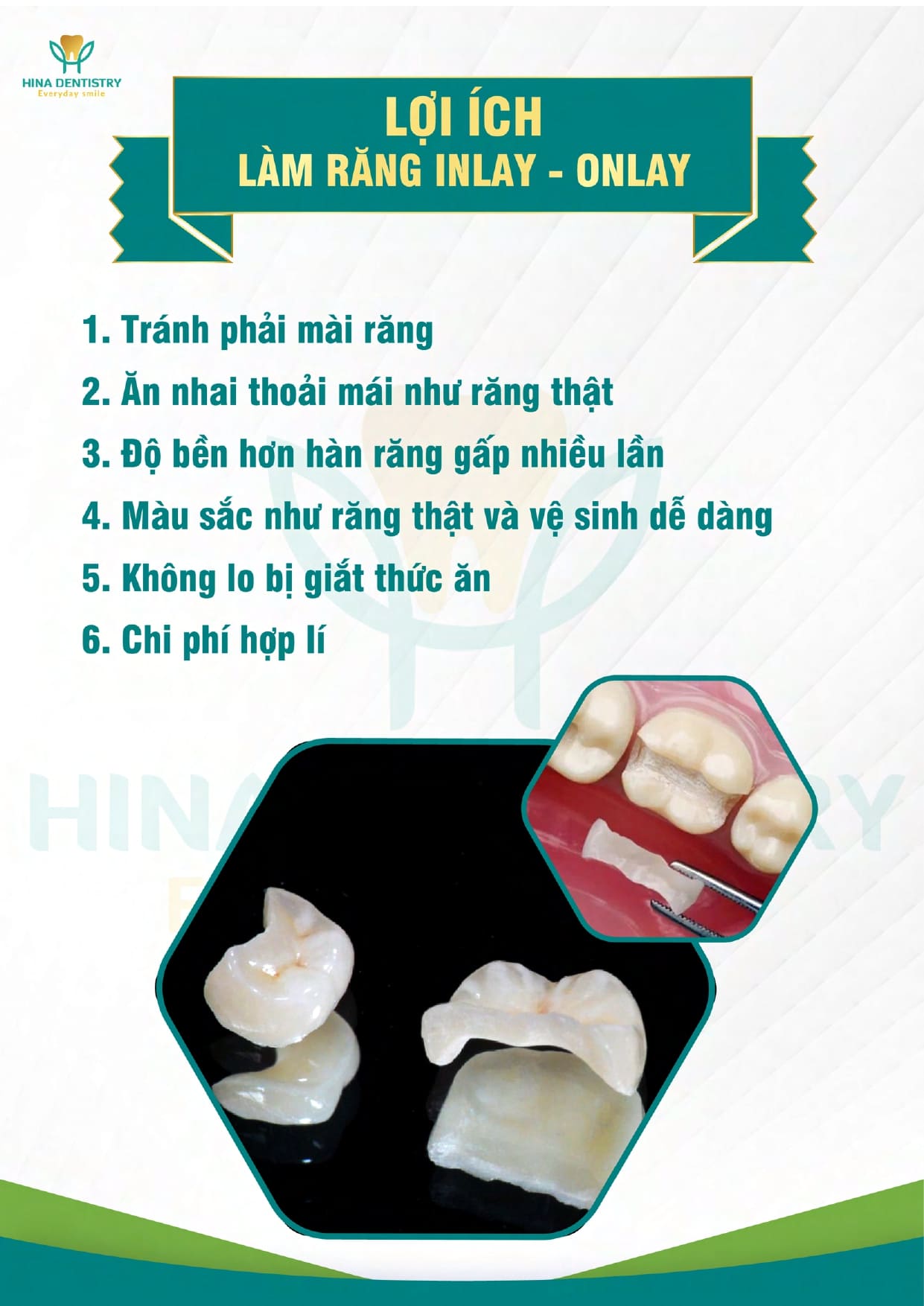 Bảng giá