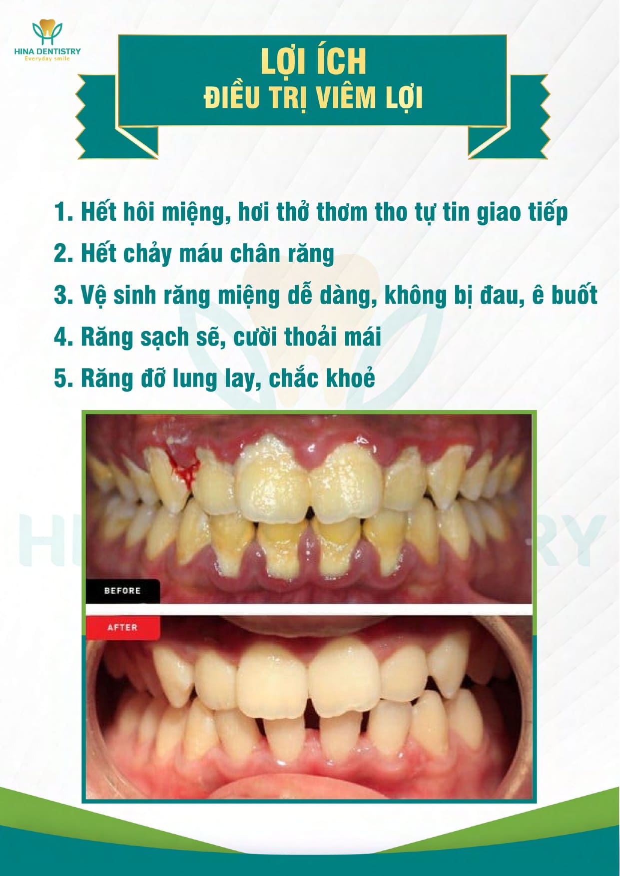 Bảng giá