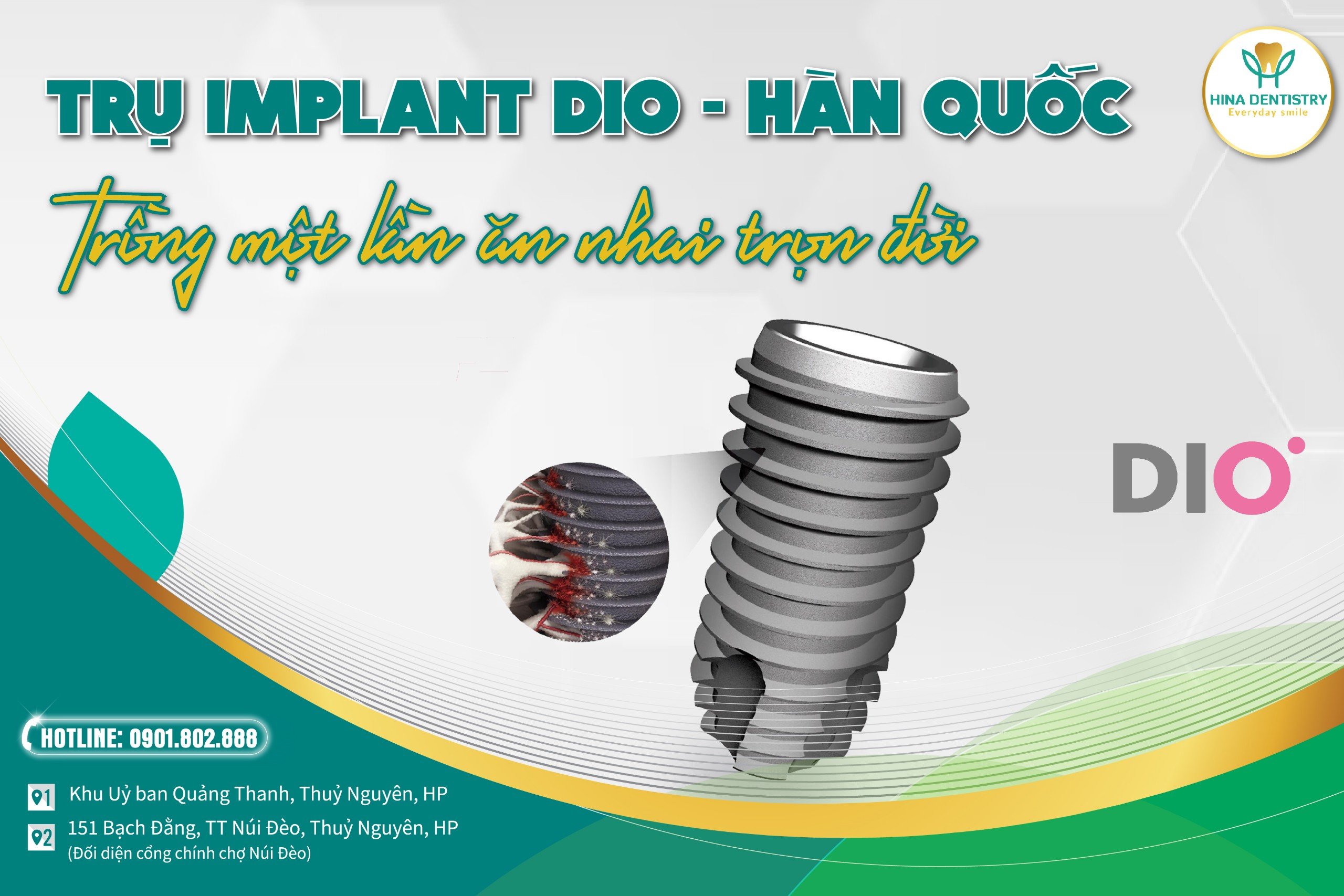 Trụ Implant Dio Hàn Quốc