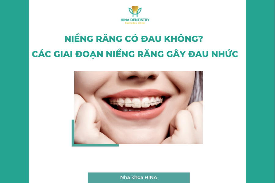 Niềng răng có đau không? Các giai đoạn niềng răng gây đau nhức