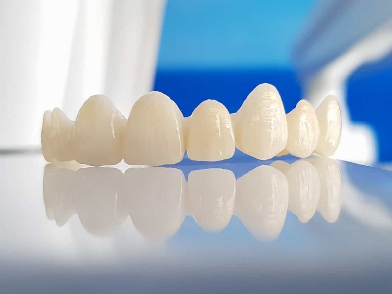 Răng sứ thầm mỹ - Giải pháp mang lại nụ cười trắng sáng
