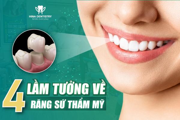 4 lầm tưởng về răng sứ thẩm mỹ