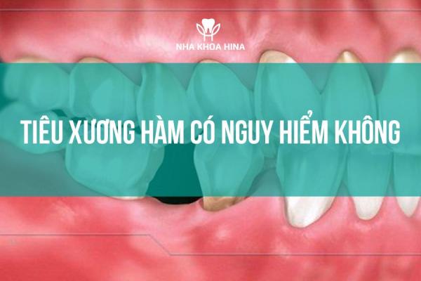 Tiêu xương hàm có nguy hiểm không?