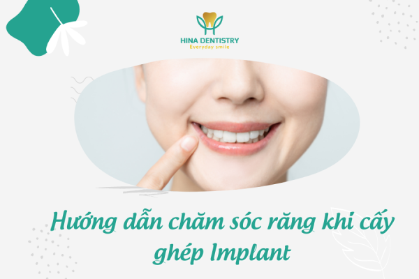 Hướng dẫn chăm sóc răng khi cấy ghép Implant