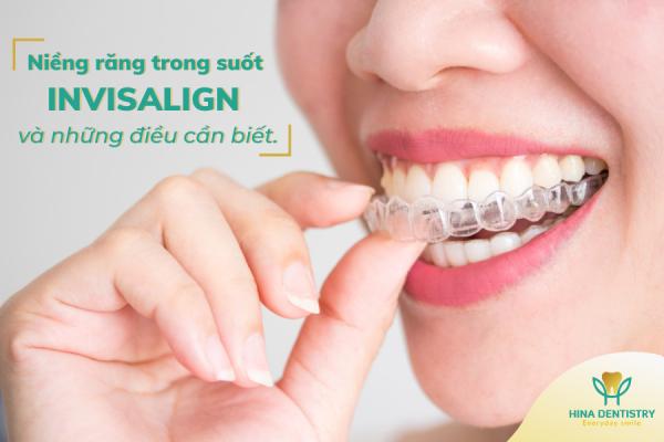 Niềng răng trong suốt INVISALIGN và những điều cần biết.