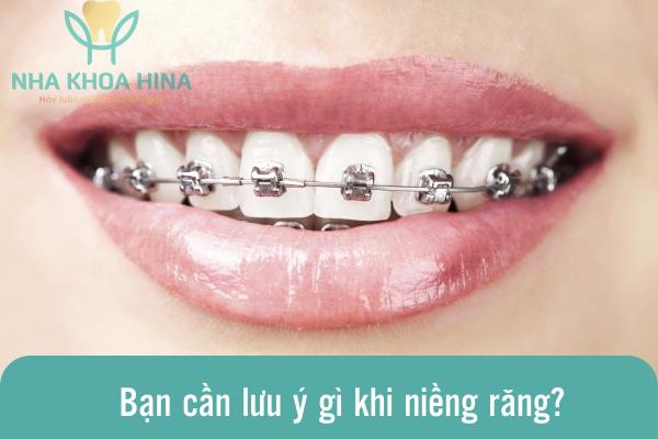 Bạn cần lưu ý gì khi niềng răng?