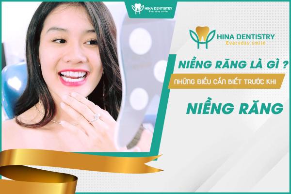 Niềng răng là gì? Những điều cần biết trước khi quyết định niềng răng