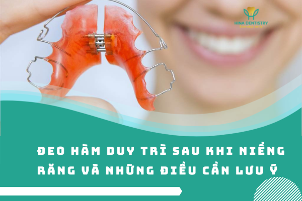 Đeo hàm duy trì sau khi niềng răng và những điều cần lưu ý