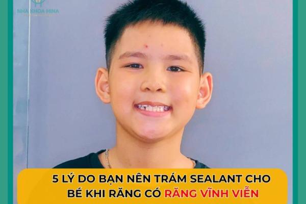 5 Lý do bạn nên trám Sealant cho bé ngay khi có răng vĩnh viễn