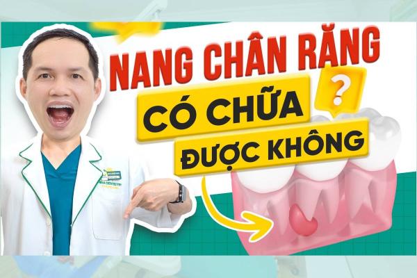 Đừng Chủ Quan Với Nang Chân Răng - Có Thể Chữa Được Không
