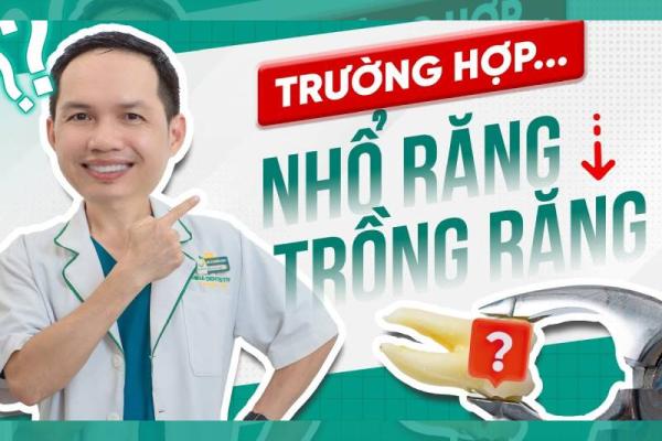 Khi Nào Cần Nhổ Răng Và Khi Nào Cần Trồng Răng